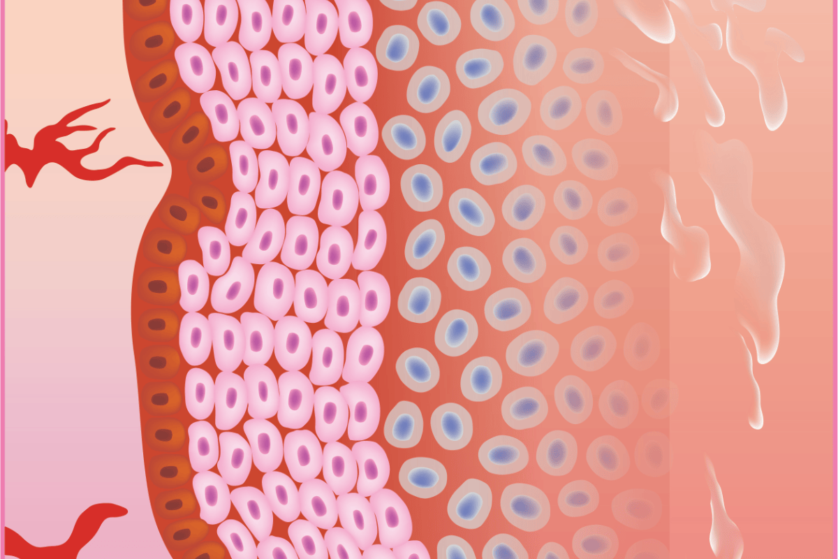 Illustration of premenopausal vaginal tissue with a thick epithelium, dense blood supply and natural moisture